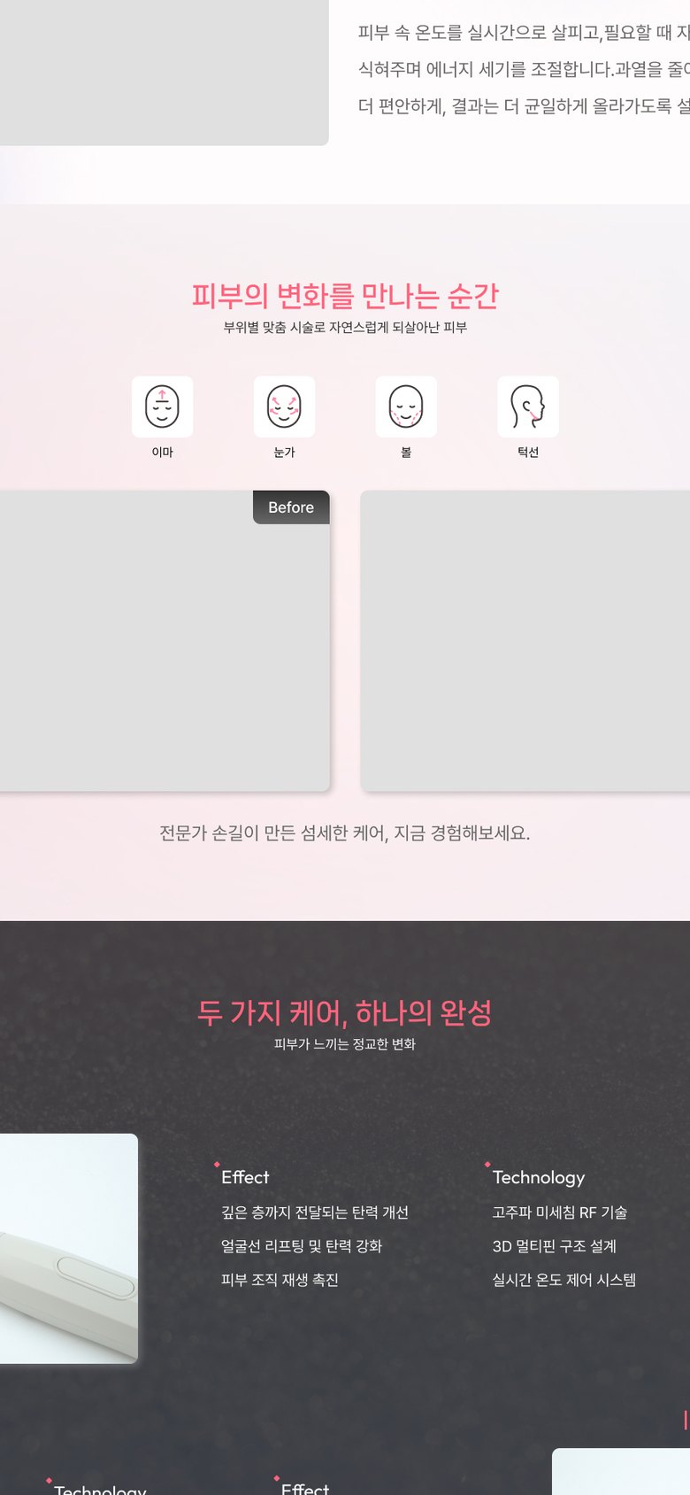 피부 리프팅 의료기기 브랜드 제품 소개 홈페이지 모바일 화면 1